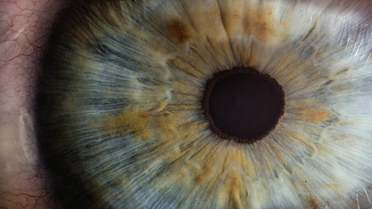 Cornea ibrida al Sant'Orsola di Bologna: metà da donatore e metà artificiale