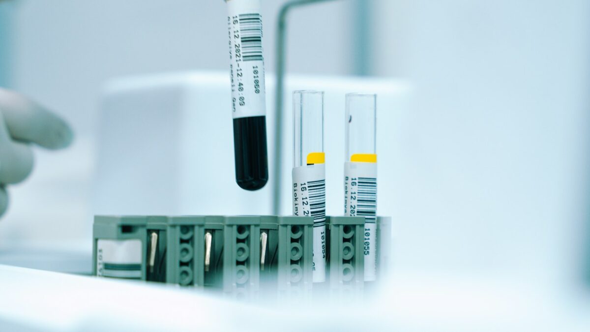 Invecchiamento del sistema immunitario: nel sangue una spia di come stiamo invecchiando